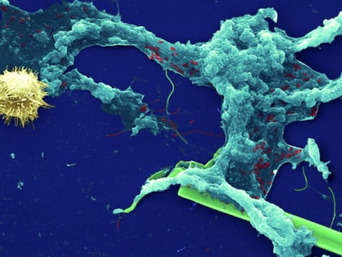 Usa l'acqua del rubinetto per lavarsi il naso e un'ameba le divora il cervello