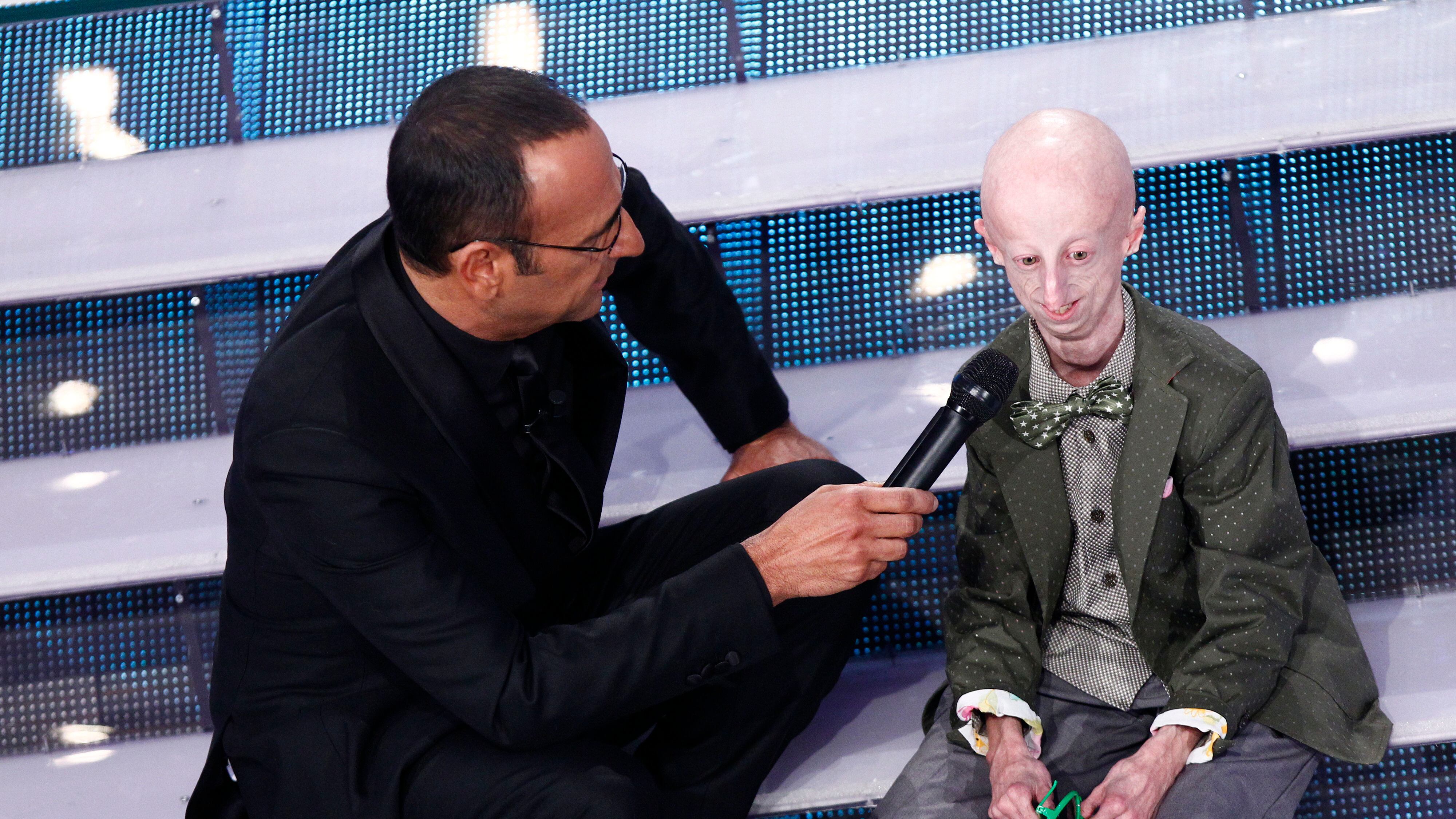 Un'altra vittoria per Sammy Basso: il 22enne affetto dalla sindrome dell'invecchiamento precoce si è laureato
