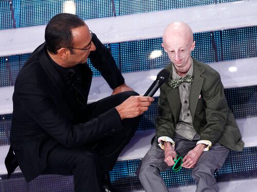 Un'altra vittoria per Sammy Basso: il 22enne affetto dalla sindrome dell'invecchiamento precoce si è laureato