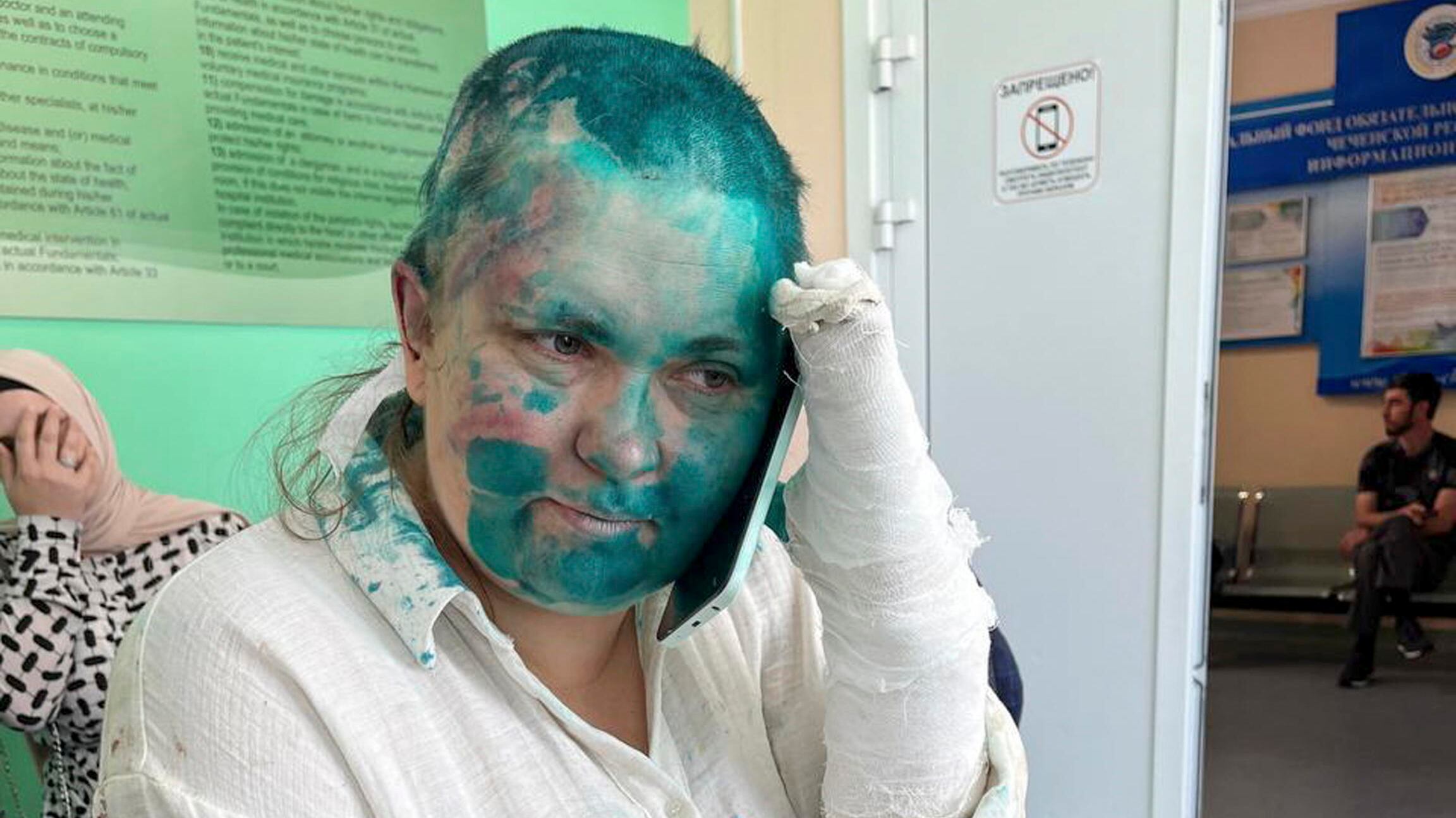 "Smetti di scrivere". Giornalista russa di Novaya Gazeta colpita con la vernice tossica