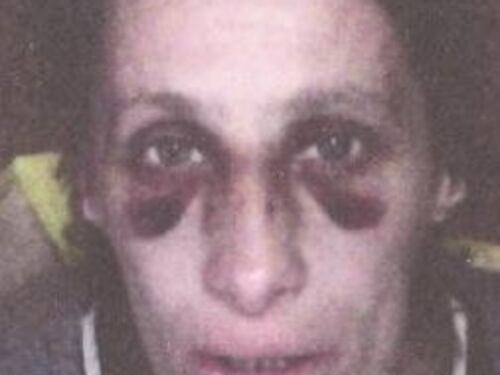 Padova, raffica di pugni in faccia: immigrato picchia donna