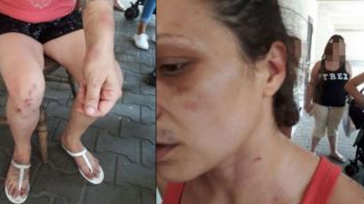 "L'eritreo ferito dal ragazzo". A Roma è rissa pure sulla rissa