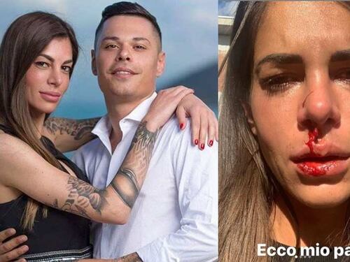"Così mi ha ridotto mio padre": le foto choc dell’ex di Temptation Island