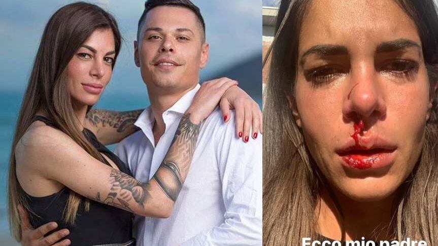 "Così mi ha ridotto mio padre": le foto choc dell’ex di Temptation Island
