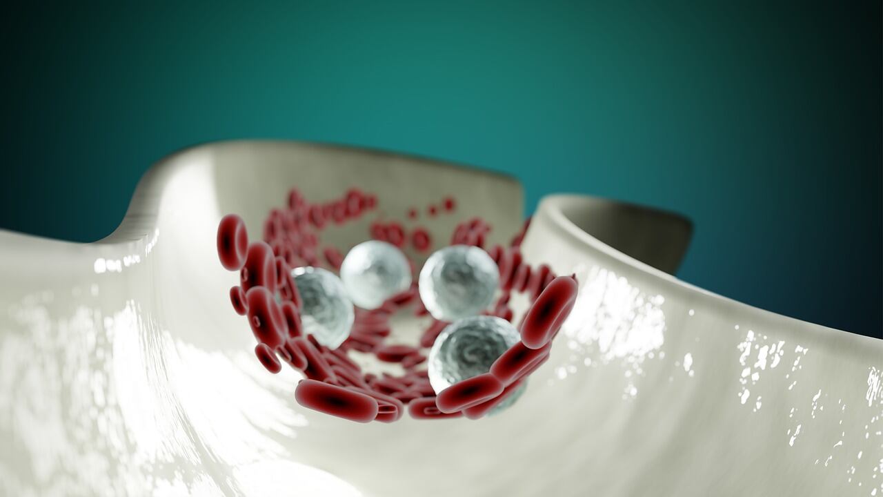 Anemia e trombosi venose nel sonno, i pericoli dell'emoglobinuria parossistica notturna