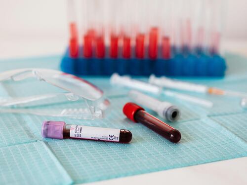 Infarti, nuovo esame del sangue: diagnosi in pochi minuti potrebbe salvare molte vite