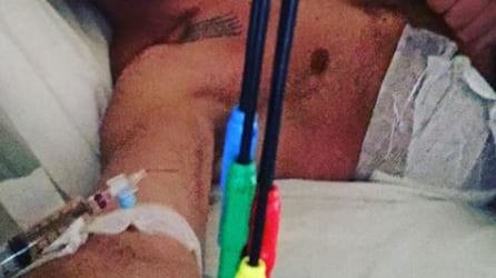 Striscia la Notizia, Edoardo Stoppa in ospedale: "Mi hanno aggredito durante un servizio"