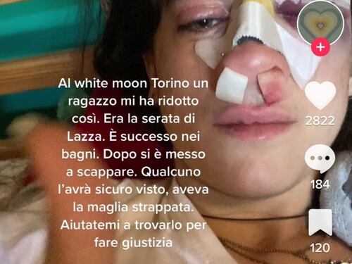 Difende il fidanzato e le rompono il naso: "Aiutatemi a trovarli"