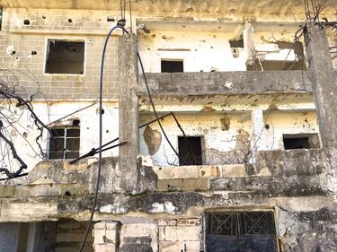 Viaggio tra corpi smembrati di una guerra senza vincitori 4