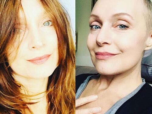 Sabrina Paravicini si sfoga sul cancro: "La chemio si è portata via la malinconia degli anni passati"