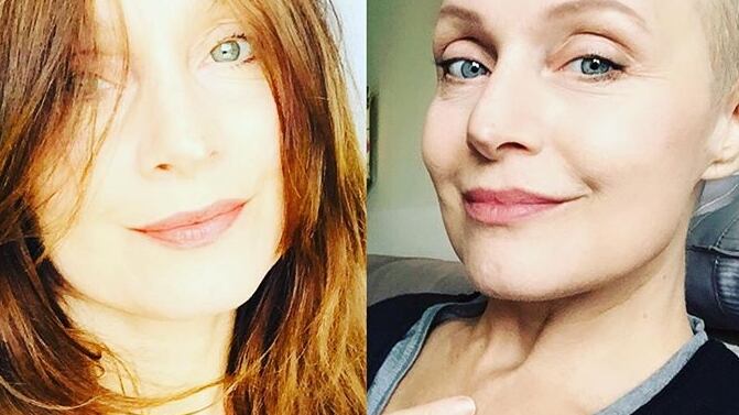 L'attrice di Un medico in famiglia e il doloroso racconto sulla malattia
