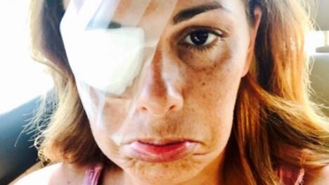 Vanessa Incontrada ferita su Instagram: "Un trucco mi ha fatto allergia"