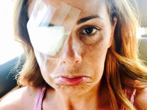 Vanessa Incontrada ferita su Instagram: "Un trucco mi ha fatto allergia"