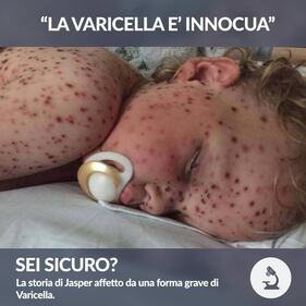 Vaccini, le foto choc: cosa succede a chi non si vaccina 6