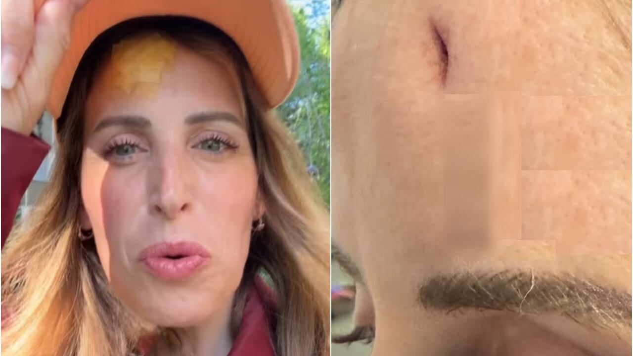 Incidente in vacanza per Cliomakeup, l'influencer finisce in ospedale: "Si vedeva l'osso"