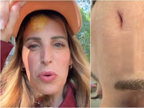 Incidente in vacanza per Cliomakeup, l'influencer finisce in ospedale: "Si vedeva l'osso"