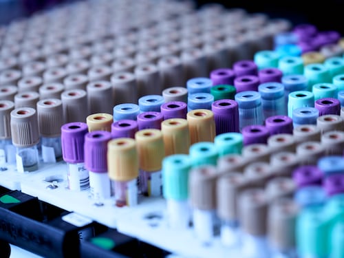 Tumore al cervello, la speranza arriva da una proteina