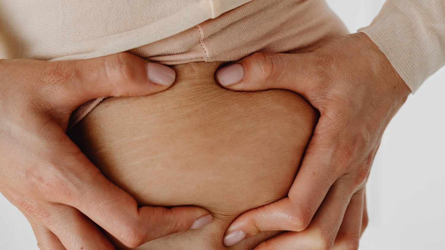 Smagliature a 60 anni: cosa mangiare e rimedi naturali