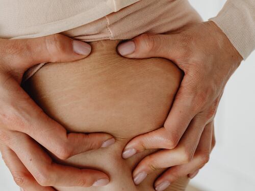 Smagliature a 60 anni: cosa mangiare e rimedi naturali