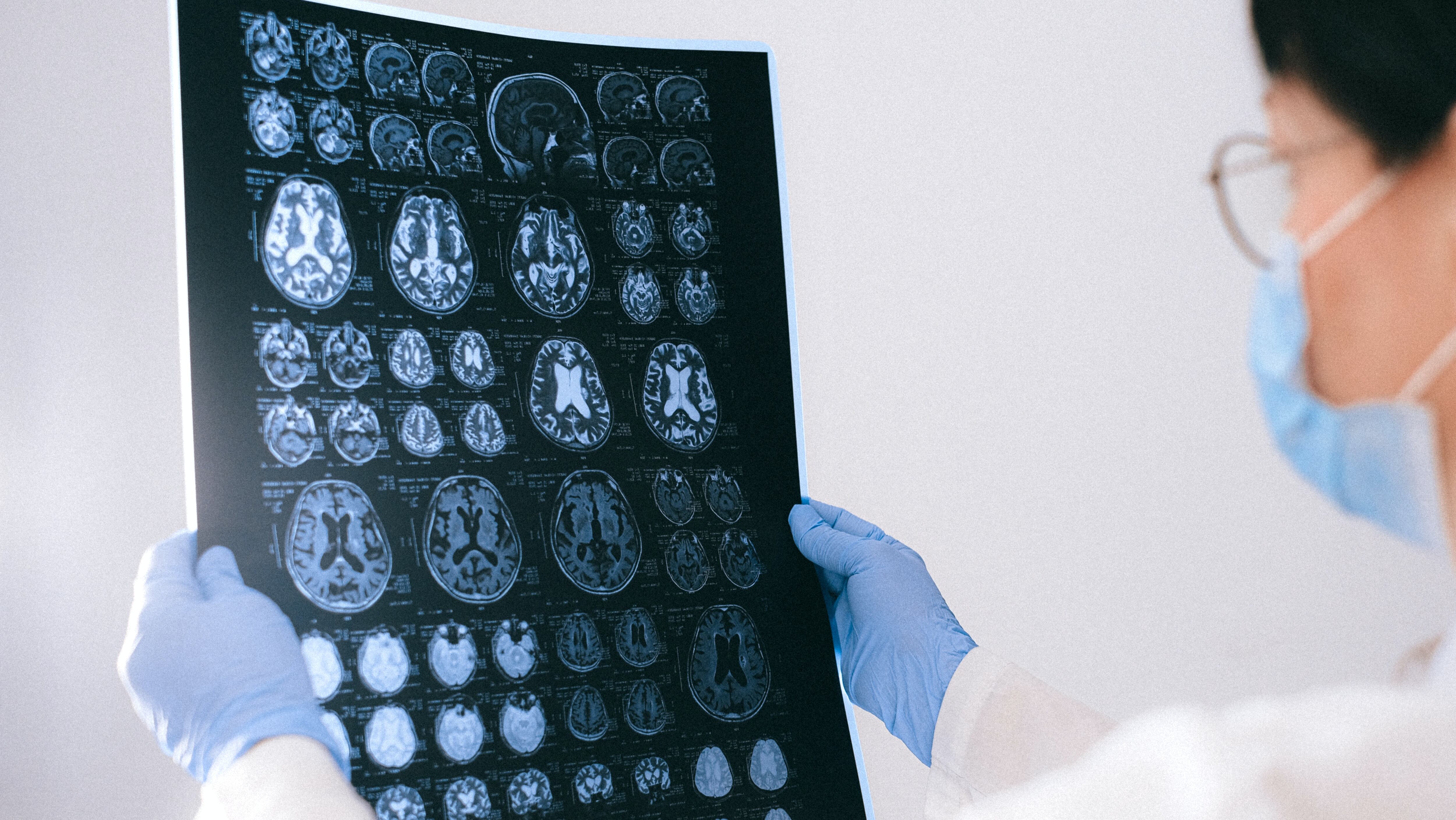 Trauma cranico adulti e bambini: quando preoccuparsi