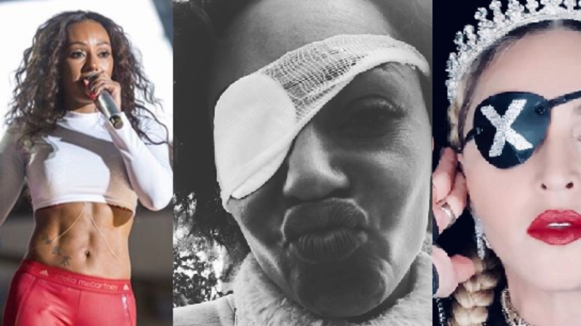 Spice Girls: Mel B teme di essere diventata cieca