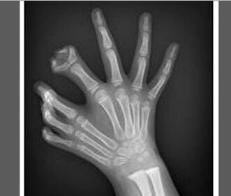 Pazze radiografie: gli oggetti che possono finire nel corpo umano 10