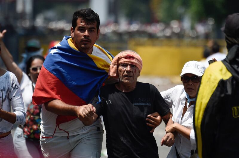 Scontri  al confine fra Venezuela e Colombia 10