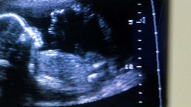 Rodrigo, il bambino nato senza un volto: sospeso il medico