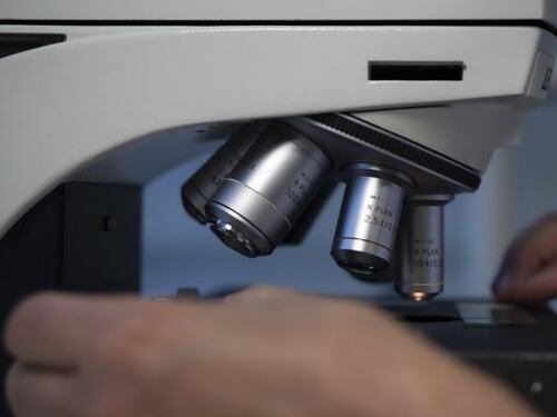 Così il sangue ci dice se abbiamo l'Alzheimer