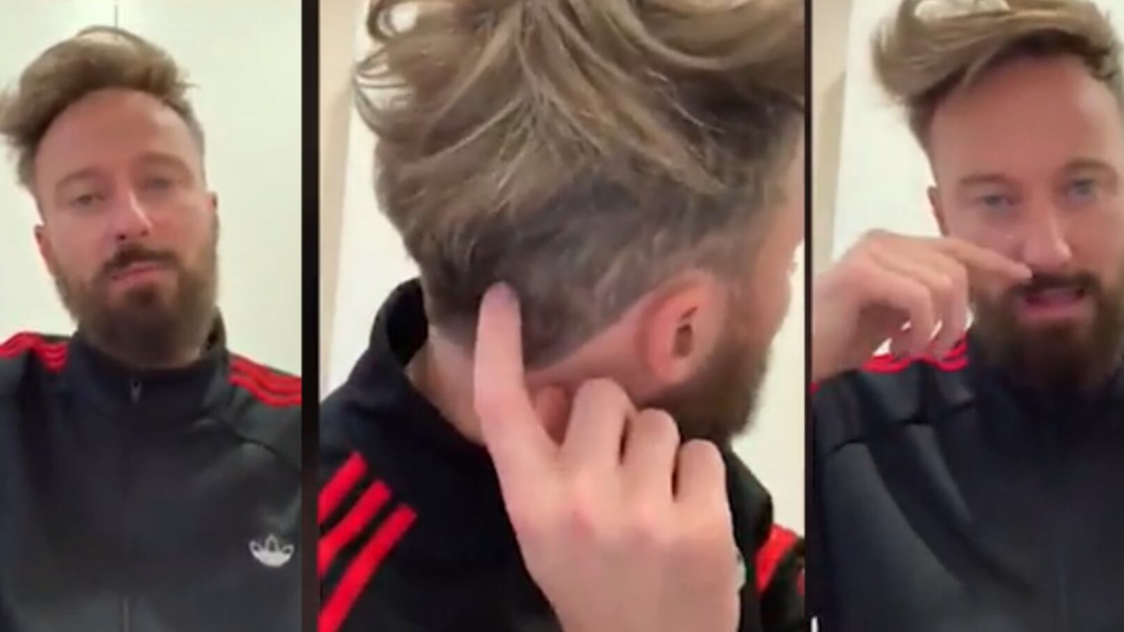 Francesco Facchinetti rivela il suo trapianto non chirurgico: "Ho i capelli da Re Leone!"