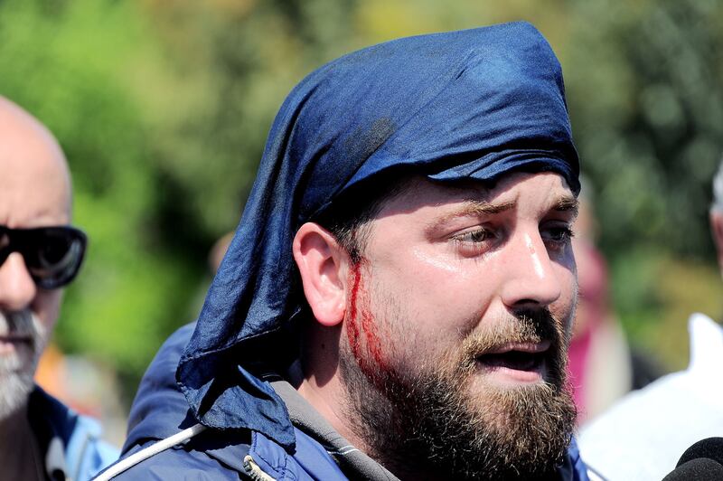 Antagonisti contro la polizia a Pisa 3