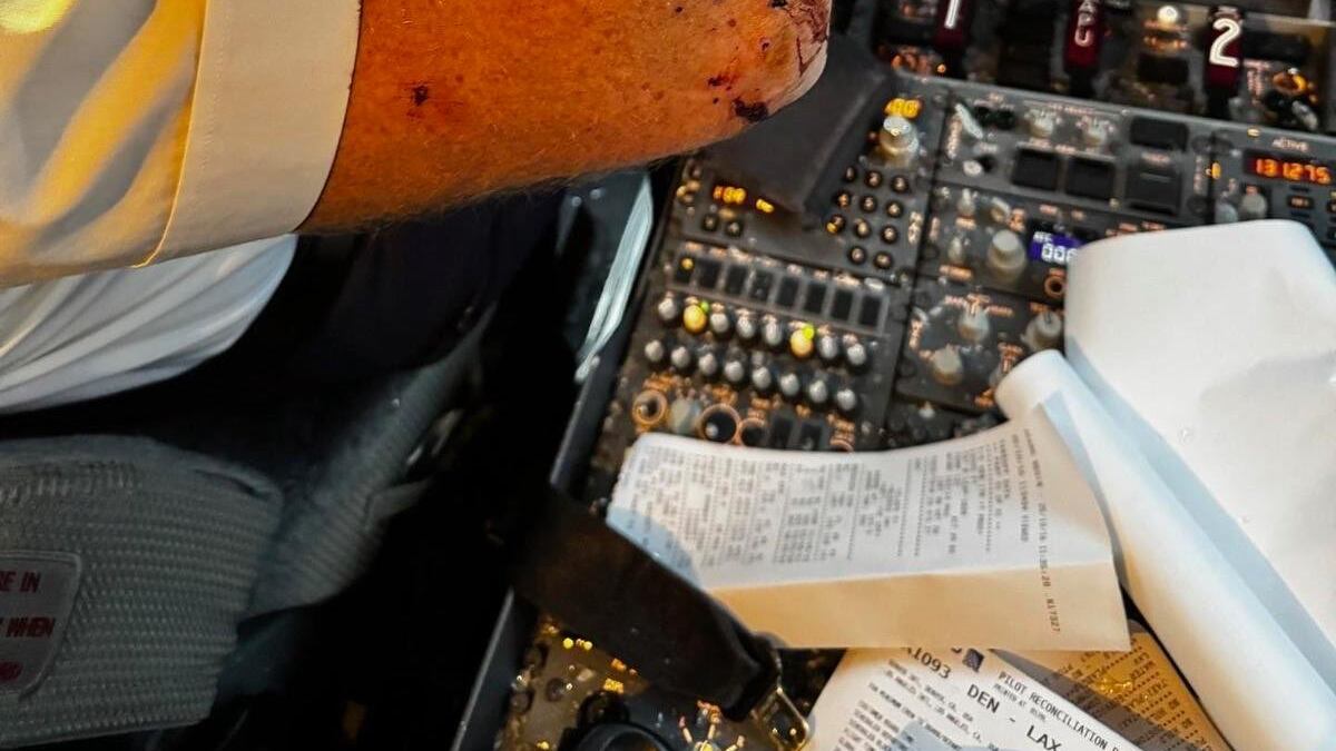 Paura a 11 mila metri di altezza, aereo colpito da un possibile "detrito spaziale": ferito il pilota