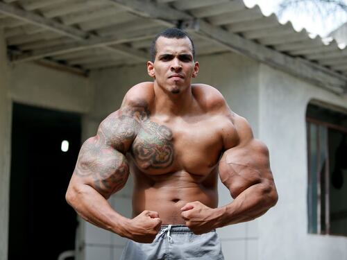 Bodybuilder si inietta olio e medicine per aumentare i muscoli: rischia la vita