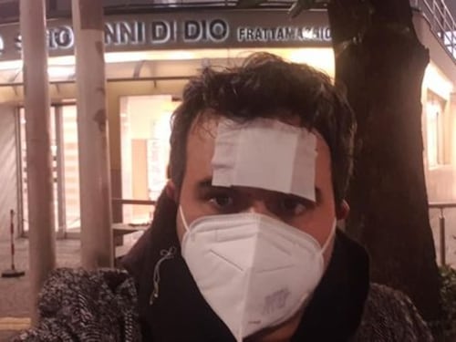 Docente picchiato a sangue per aver richiamato gli alunni. "Temo che i mandanti siano i genitori"