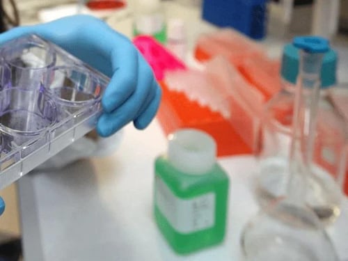 Cancro alla vescica, Berardi (Aiom): "Sangue nelle urine segnale da non sottovalutare"