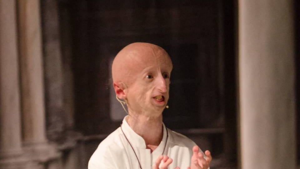 Sammy Basso, malato di progeria, operato con successo al cuore