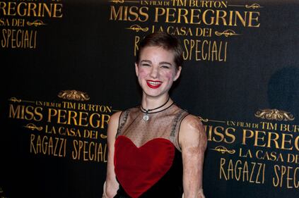Bebe Vio, dalla medaglia d'oro al jet set 20