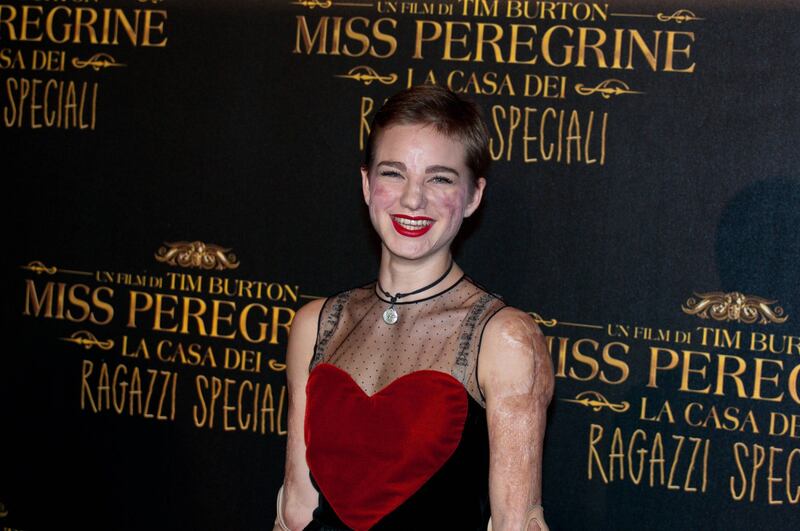 Bebe Vio, dalla medaglia d'oro al jet set 20