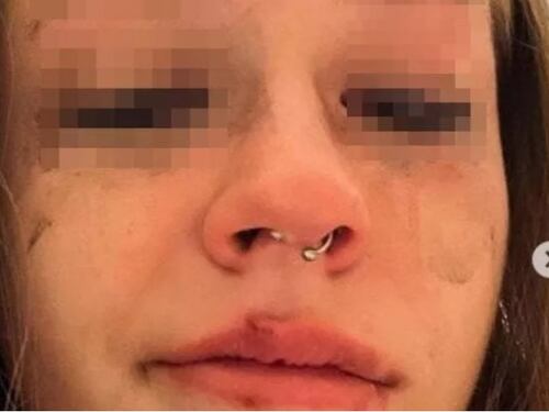 "Ecco chi è". La foto choc della 18enne contro l'ex, lui la querela