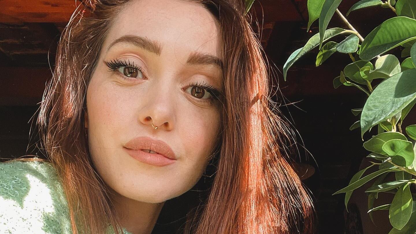 Cos'è la tricodinia, il problema ai capelli dell'influencer Camihawke