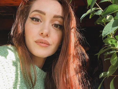 Cos'è la tricodinia, il problema ai capelli dell'influencer Camihawke