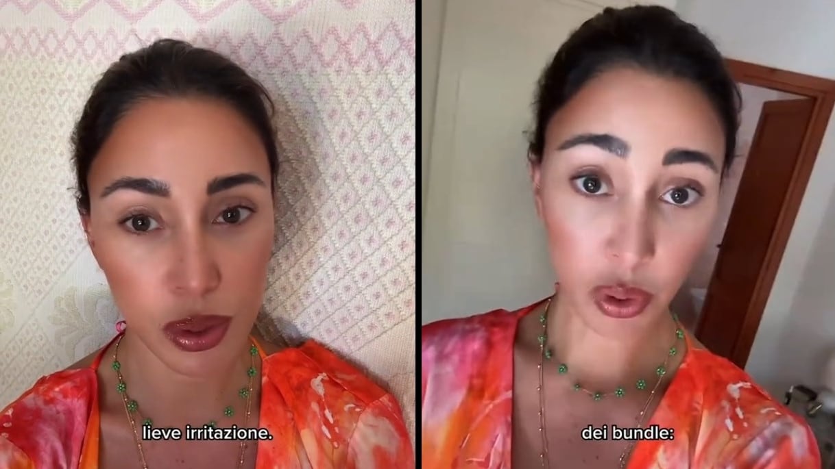 "Cos'ha fatto in faccia?" Bufera social su Belen: cosa è successo