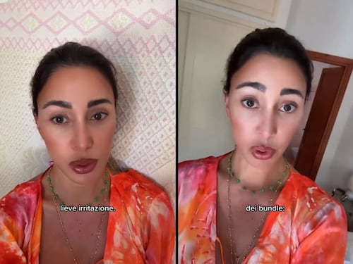 "Cos'ha fatto in faccia?" Bufera social su Belen: cosa è successo
