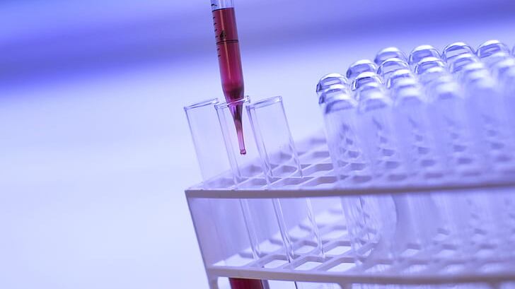 Carcinoma gastrico, cosa migliora la sopravvivenza
