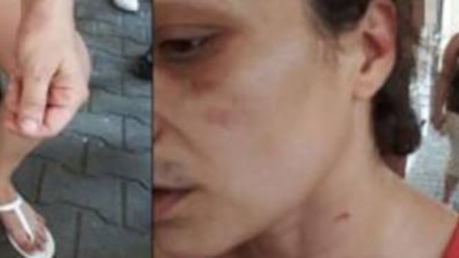 Eritreo ferito, donna indagata per lesioni aggravate