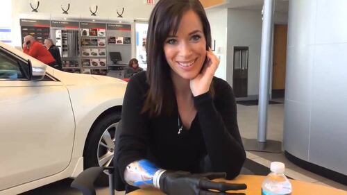 Rebekah Marine, la modella col braccio bionico 2