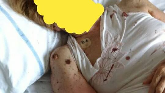 Che ipocrita la politica in fuga dalle formiche della malasanità