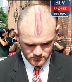 Rooney pubblica le foto del suo infortunio e sul web scatta la satira 4