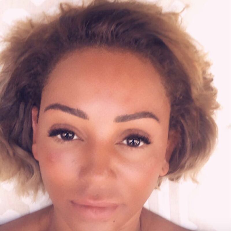 Mel B, le foto della cantante 10