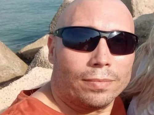 Sfregiato con l'acido dalla ex, nuovi arresti in vista